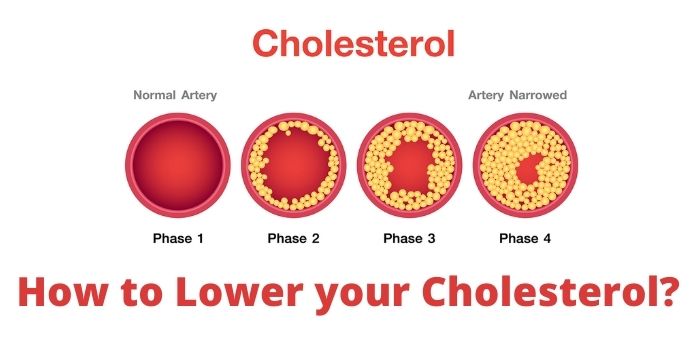 How to Lower your Cholesterol
