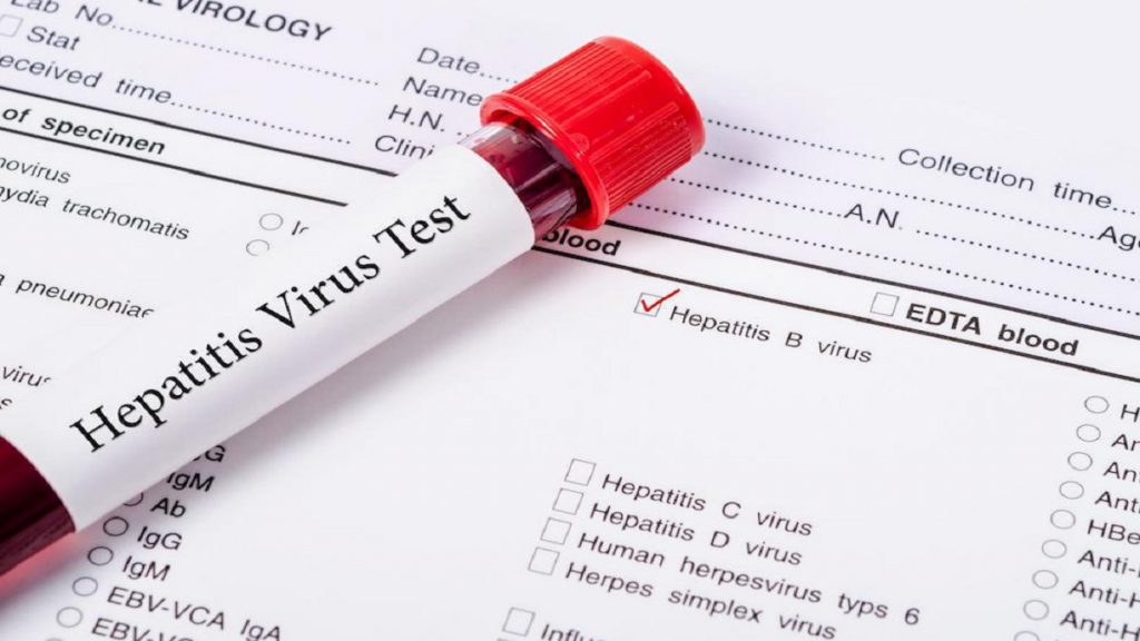 Hepatitis C Blood Test