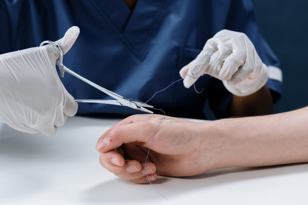 a person getting stitches on their hand